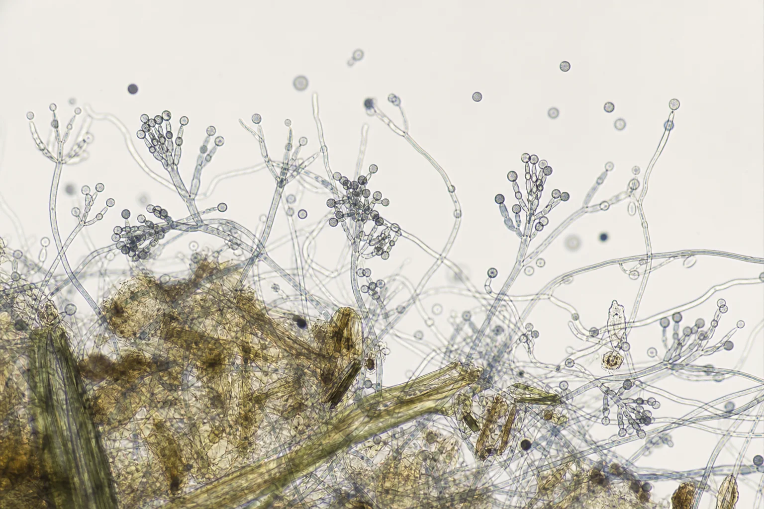 Microscopic image or careful illustration of mold spores on plant tissue - educational