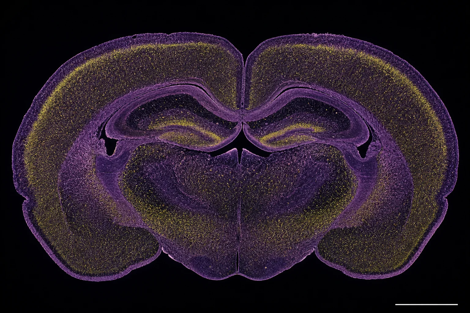 Macro photomicrograph of a rodent brain slice used in cannabinoid pharmacology with scale bar (non-readable).